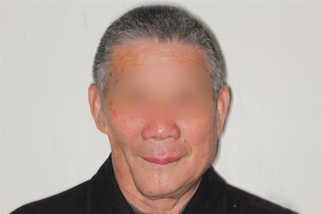 华中首例！3D打印钛合金“下颌骨”植入74岁老人面部